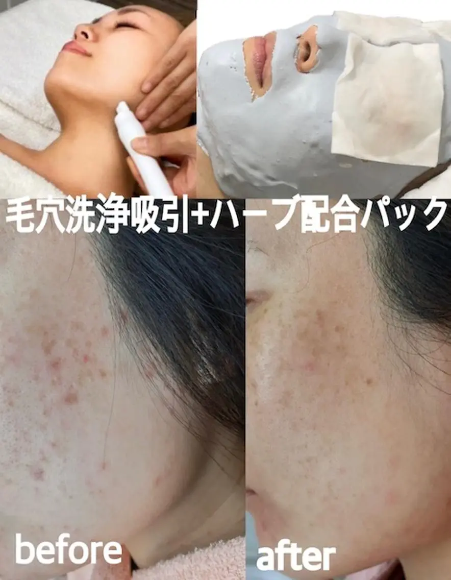 肌ケア&毛穴洗浄 Cheri/女性専用のエステ・リラクイメージ