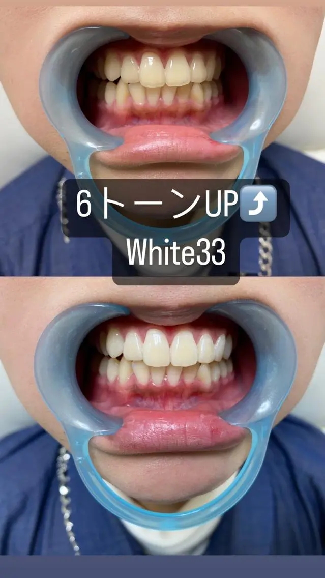 メンズ メンズパーマ セルフホワイトニング White33大名のその他イメージ