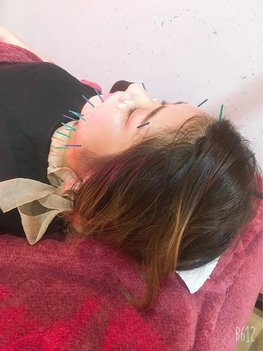 ショート カラー パーマ ヘアアレンジ メンズ キッズ ネイル マツエク・マツパ 美容鍼灸女性専用 りんご鍼灸治療院のエステ・リラクイメージ