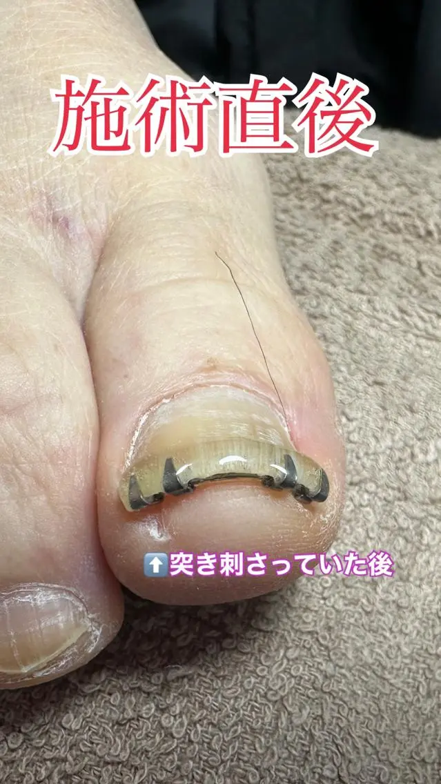 ネイル ○△□ 守口市のネイルデザイン