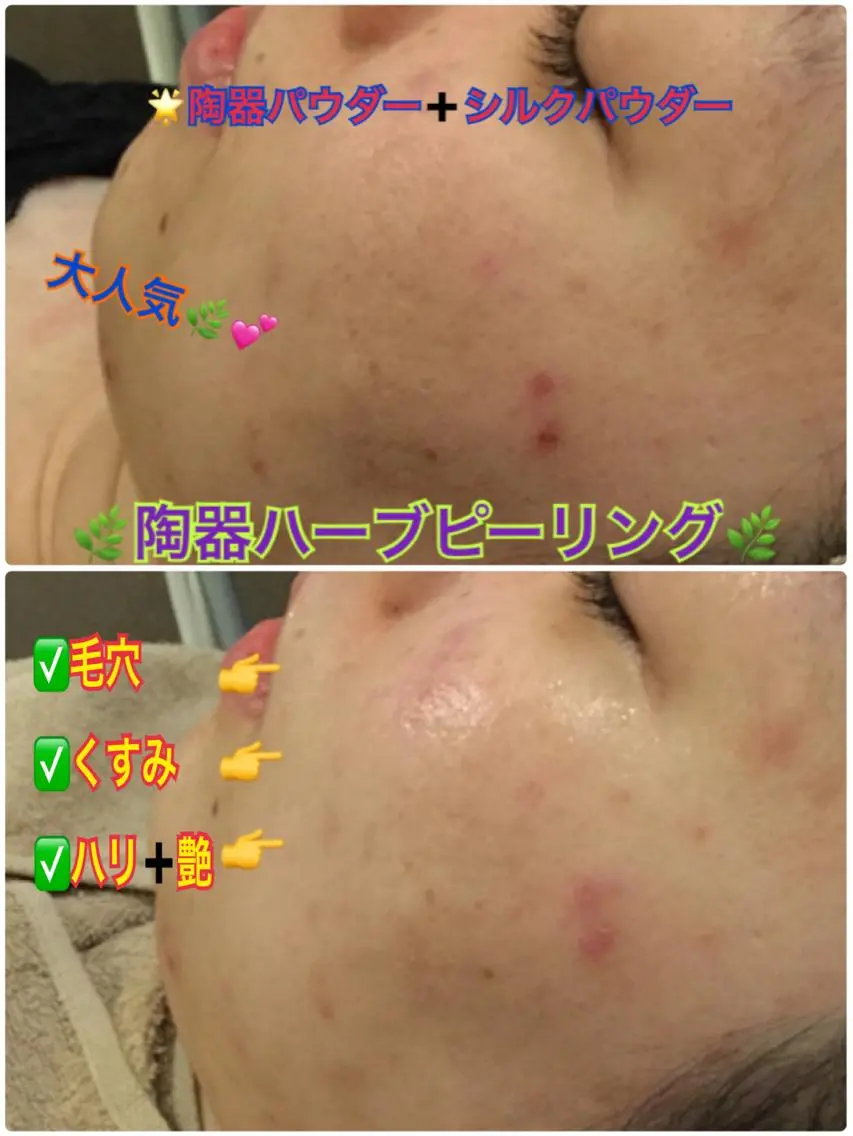エステ Dione 立川店のエステ・リラクイメージ