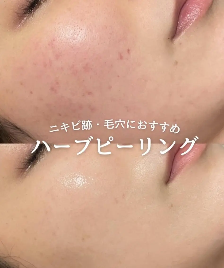 エステ A🎀Ni na🫧のエステ・リラクイメージ