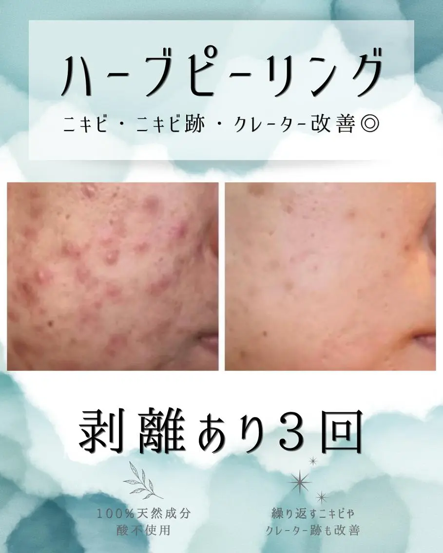 エステ リラク 医療提携 肌管理痩身エステ池袋のエステ・リラクイメージ