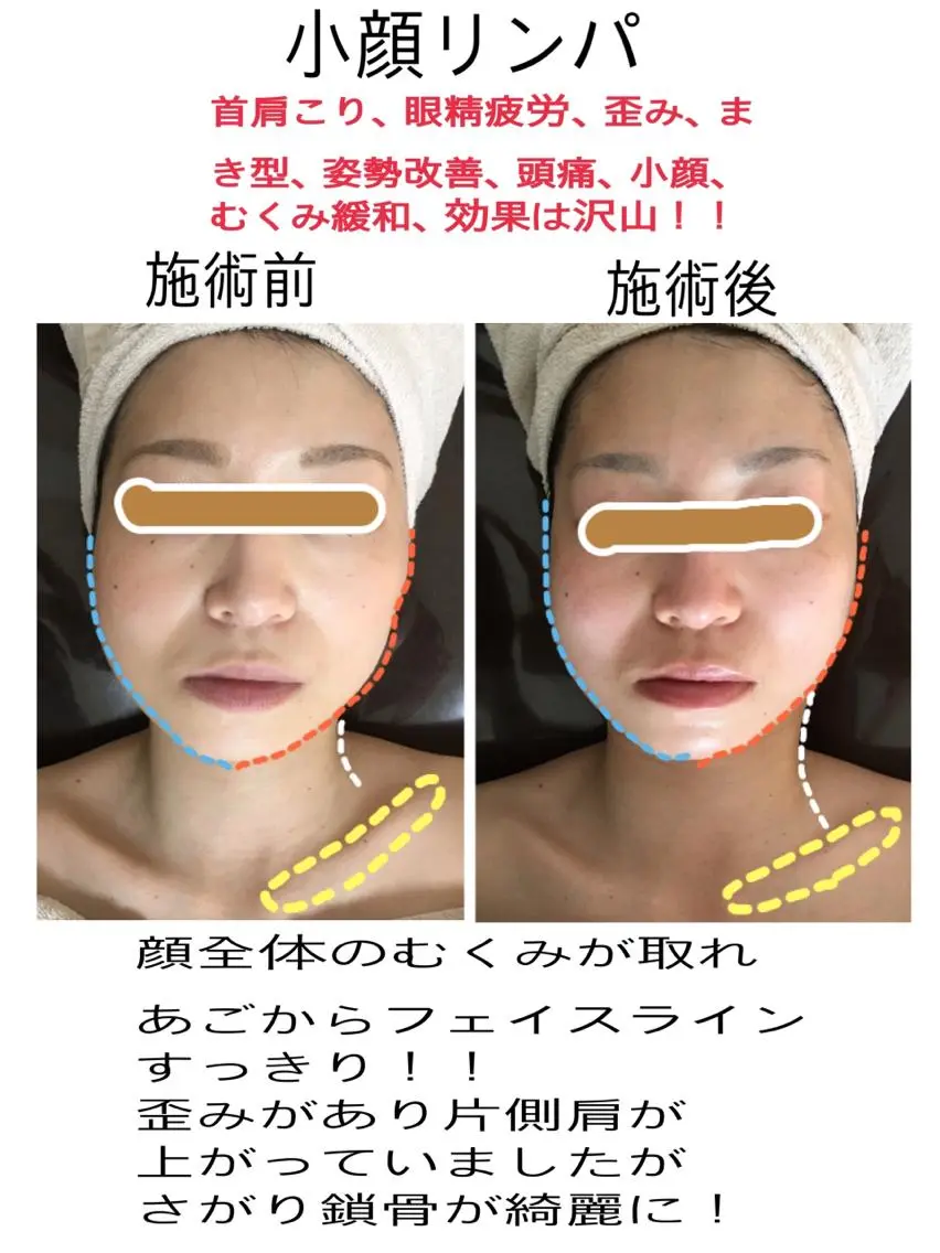 美筋骨格リンパ®️ Aroleのエステ・リラクイメージ