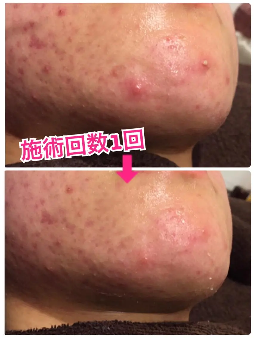 ロング カラー パーマ ヘアアレンジ メンズ キッズ ネイル マツエク・マツパ クリスマス 冬ネイル クリスマス ‍痩身＆ボディ 結果出し🌟丹野のエステ・リラクイメージ