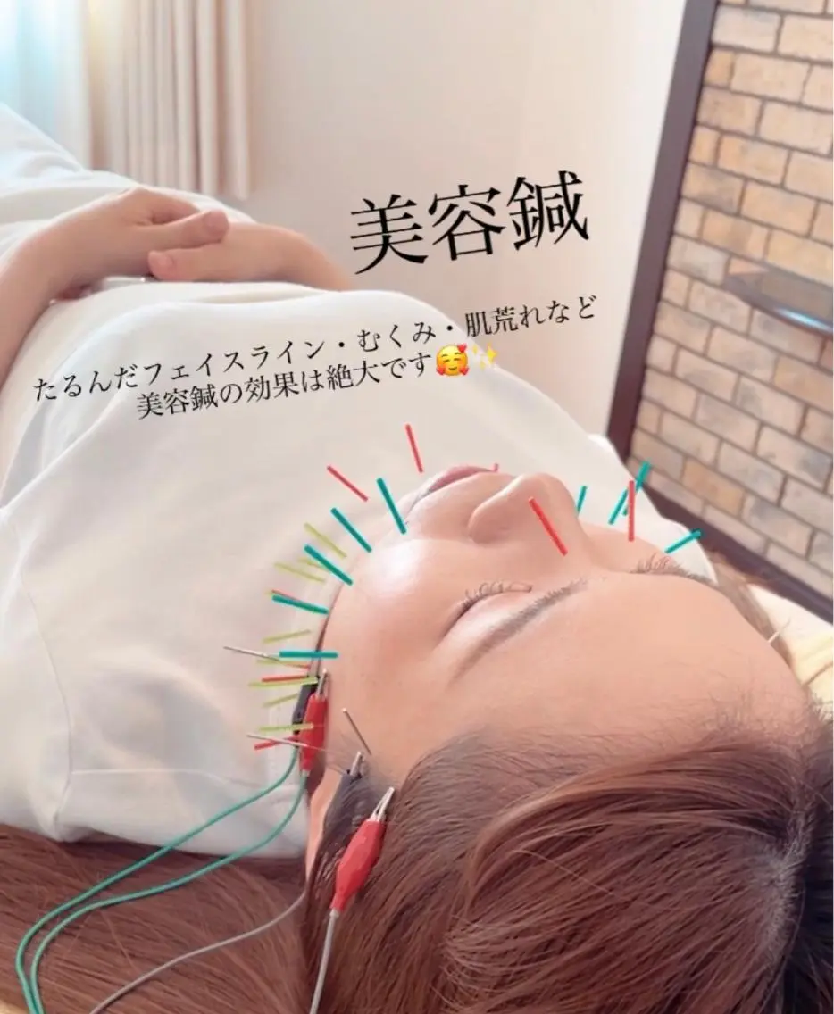 鍼灸サロン TIARA　美容鍼のエステ・リラクイメージ