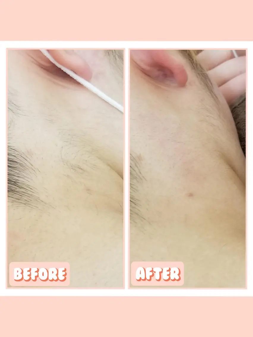 脱毛 salonde ReGodのエステ・リラクイメージ
