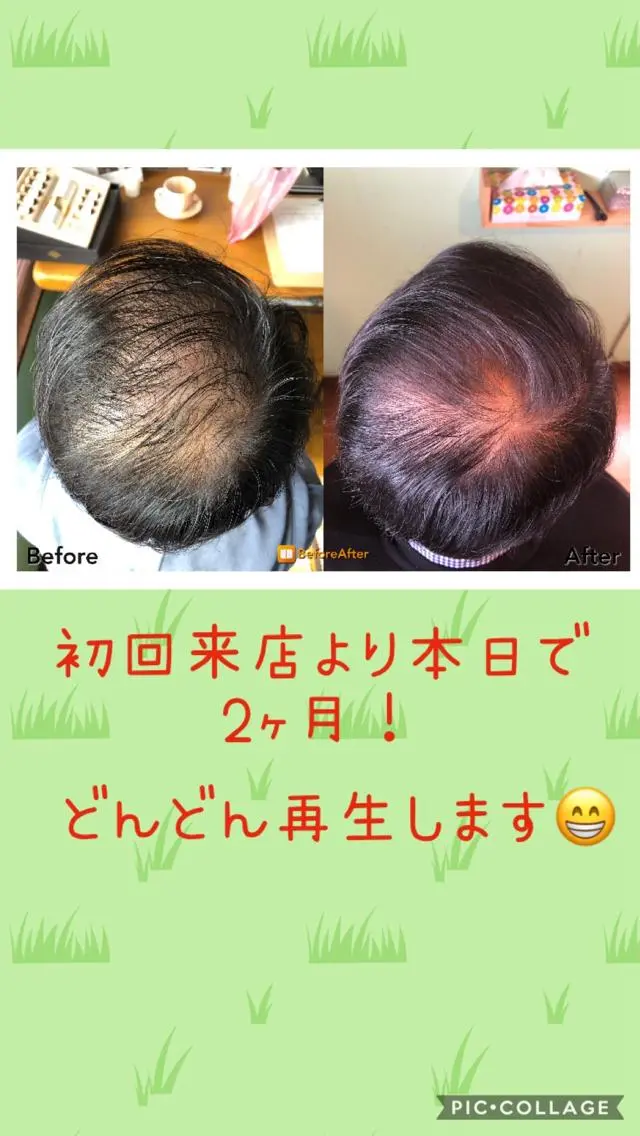 acco  フェイシャル 育毛のエステ・リラクイメージ