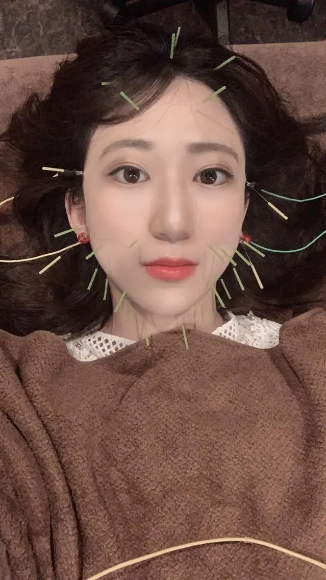 メンズ エステ リラク 美容鍼灸サロン LOMIHARIのエステ・リラクイメージ