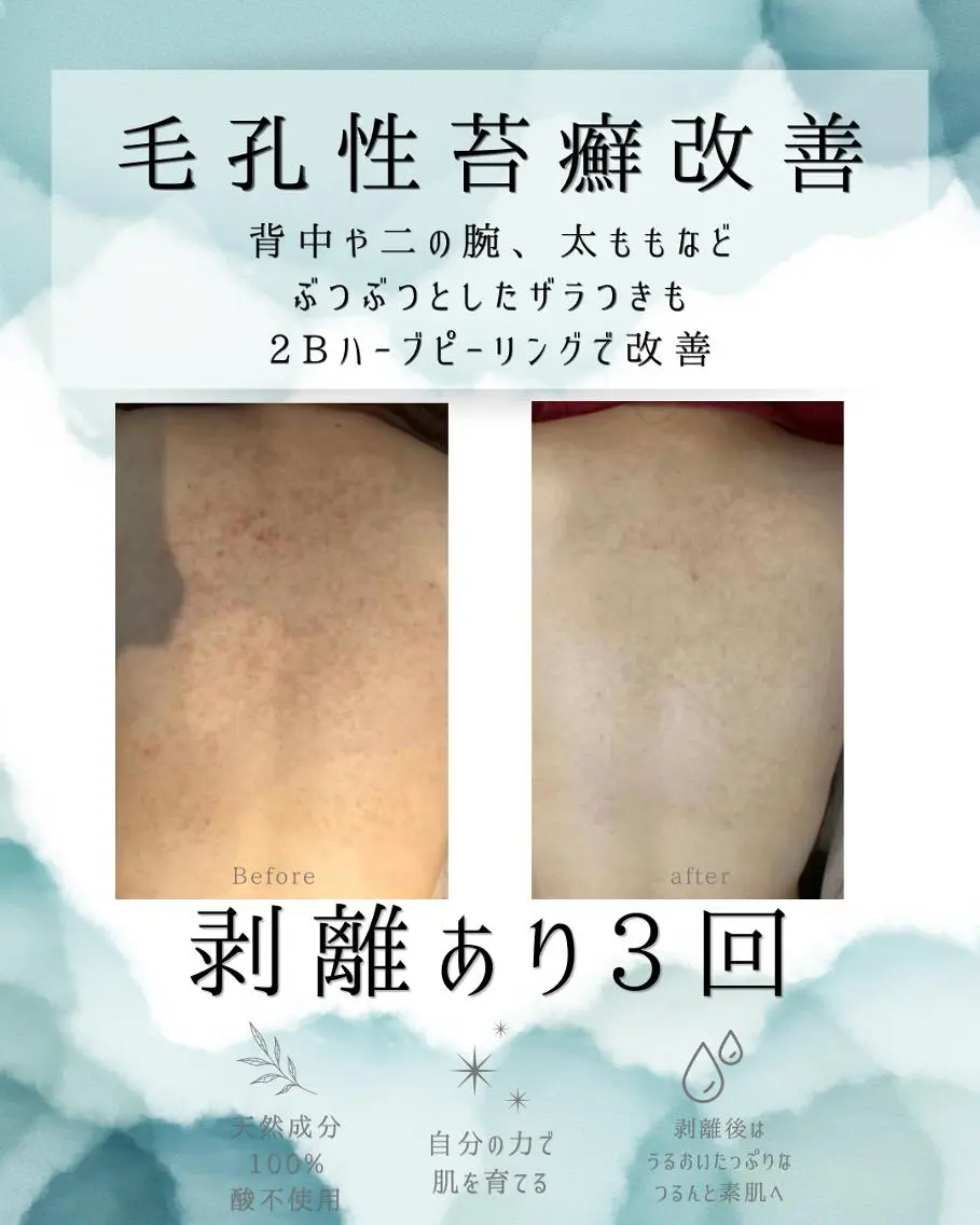 エステ リラク 医療提携 肌管理痩身エステ池袋のエステ・リラクイメージ
