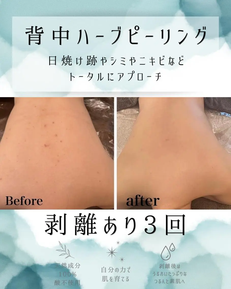 エステ リラク 医療提携 肌管理痩身エステ池袋のエステ・リラクイメージ