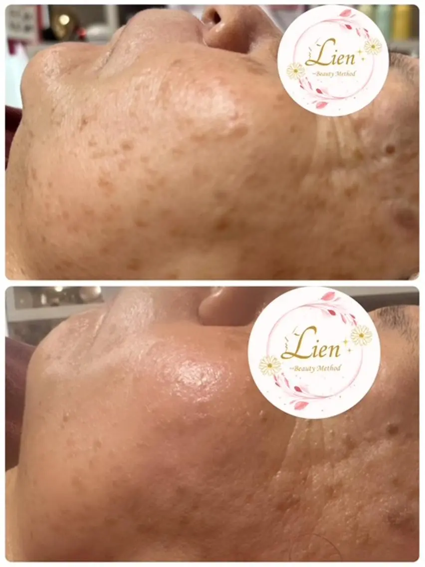 Lien オーナー　山口智嘉のエステ・リラクイメージ