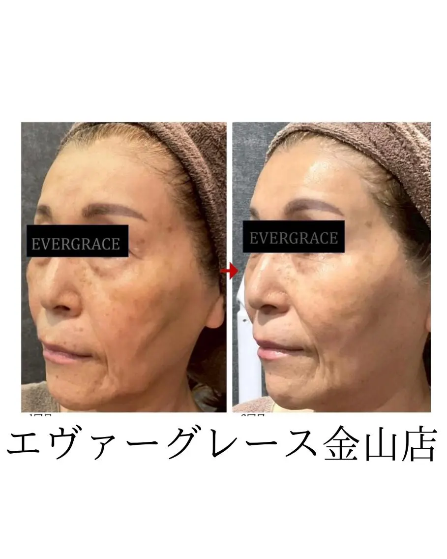 エステ リラク エヴァーグレース 金山店のエステ・リラクイメージ