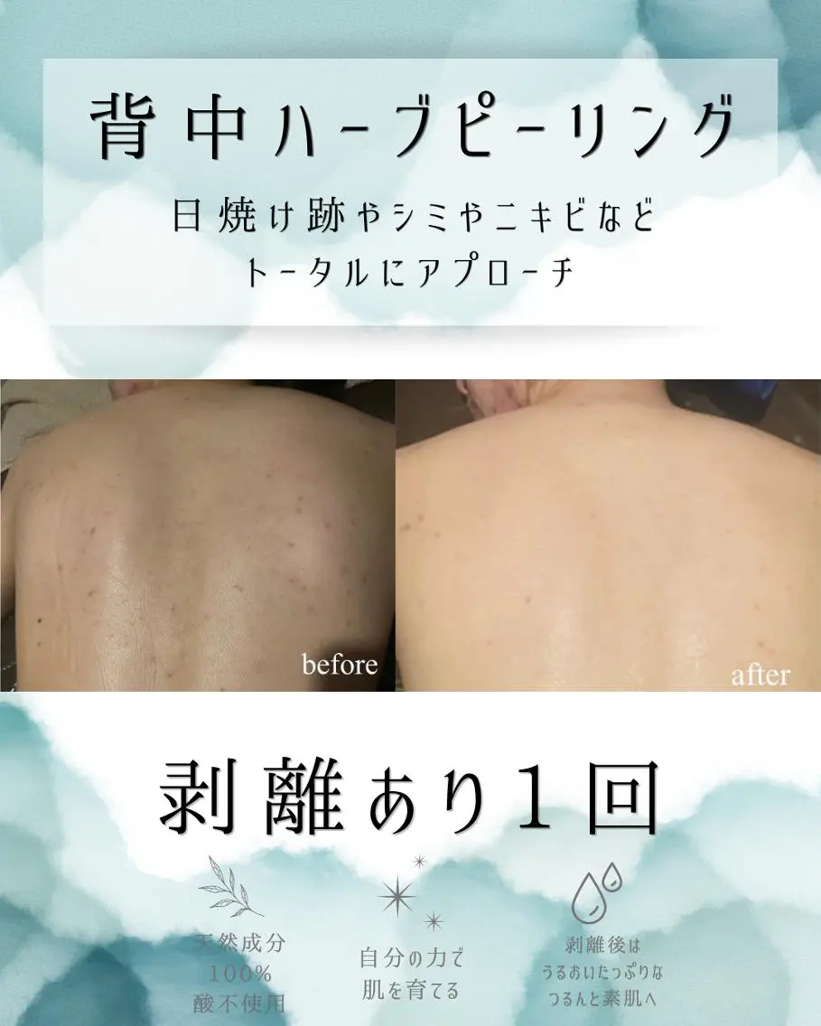 エステ リラク 医療提携 肌管理痩身エステ池袋のエステ・リラクイメージ