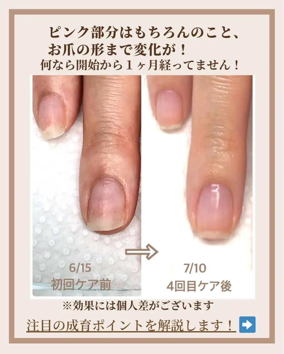 ネイル その他(ネイル) 自爪育成ネイルサロン Pause(ポーズ)のネイルデザイン