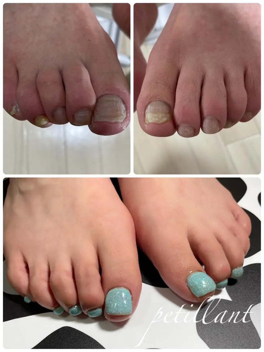 ネイル フットネイル ラメ(グリッター) nail salon petillantのネイルデザイン