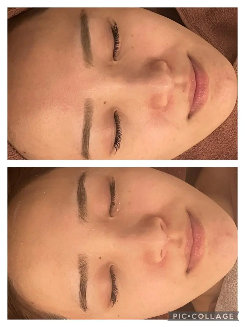 セミロング カラー パーマ ヘアアレンジ メンズ キッズ ネイル マツエク・マツパ アイブロウ 3か月で肌革命👼 ニキビ専門店💫のエステ・リラクイメージ