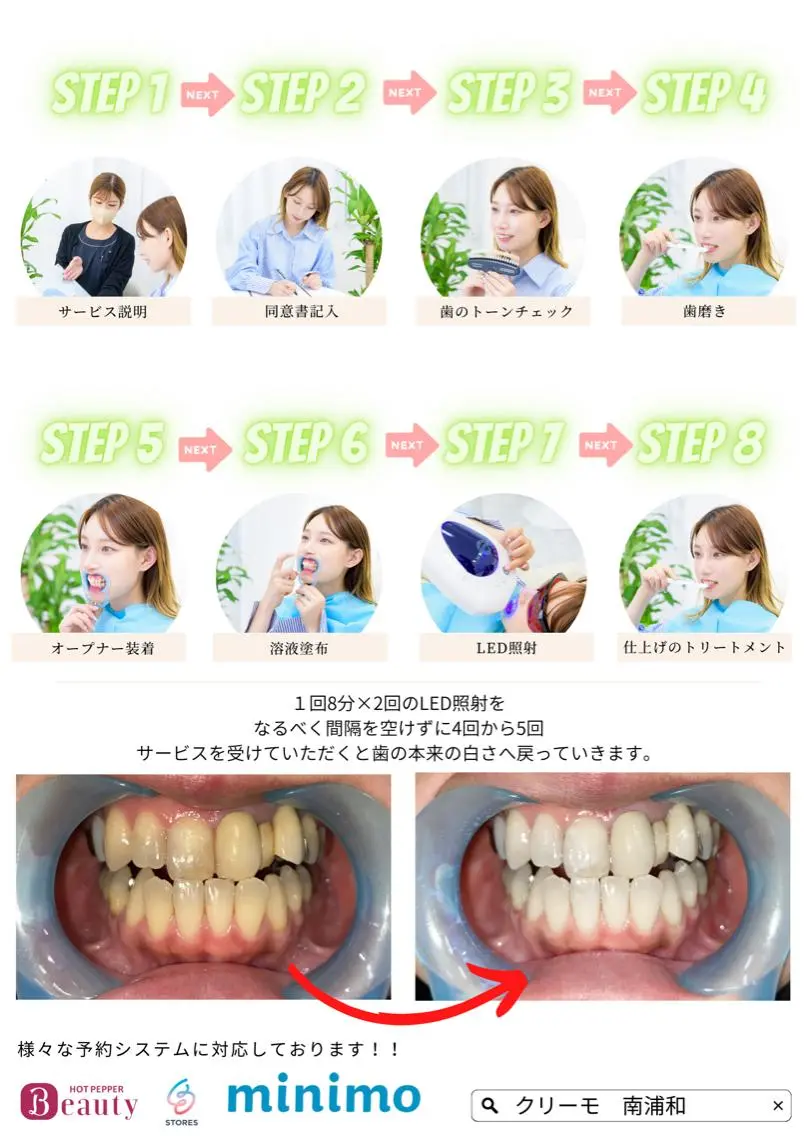 その他 歯のホワイトニング HARU南浦和のその他イメージ