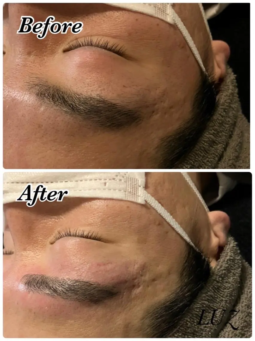 メンズ アイブロウ メンズパーマ ハリウッドブロウリフト メンズアイブロウ 眉毛ワックス脱毛 ワックス脱毛 眉カット その他(アイブロウ) LUZ｜川口メンズ 毛穴洗浄・眉毛の眉毛・アイブロウイメージ