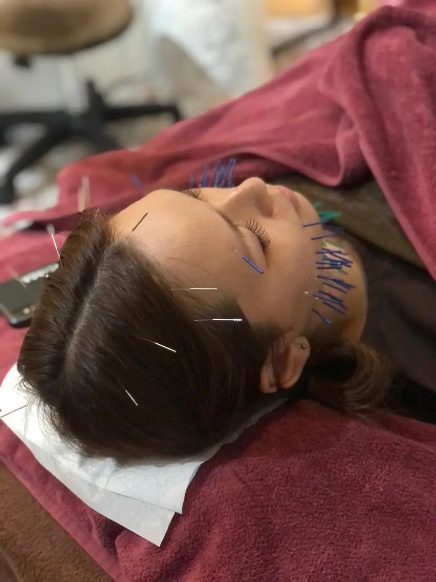 美容鍼灸女性専用 りんご鍼灸治療院のエステ・リラクイメージ