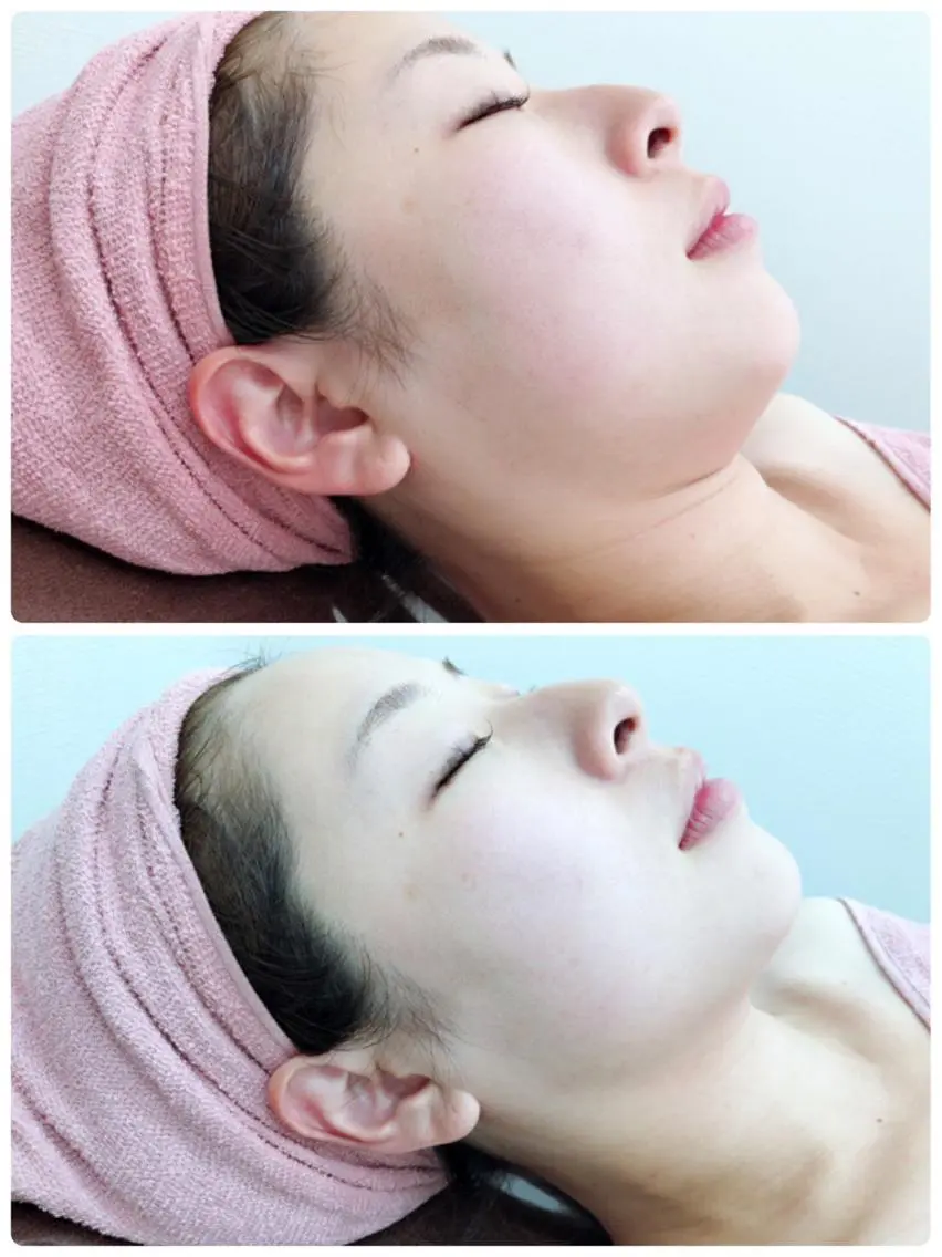 ハーブピーリングMB eautySalonのエステ・リラクイメージ