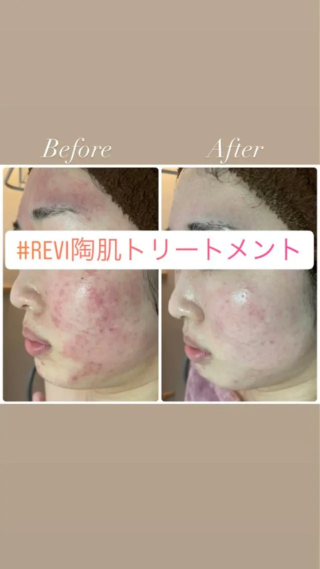NA skin たまプラーザ店のエステ・リラクイメージ