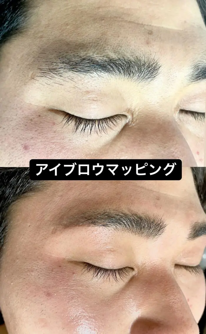 メンズ キッズ ワックス脱毛 Epina 千葉店 【エピナ】のエステ・リラクイメージ