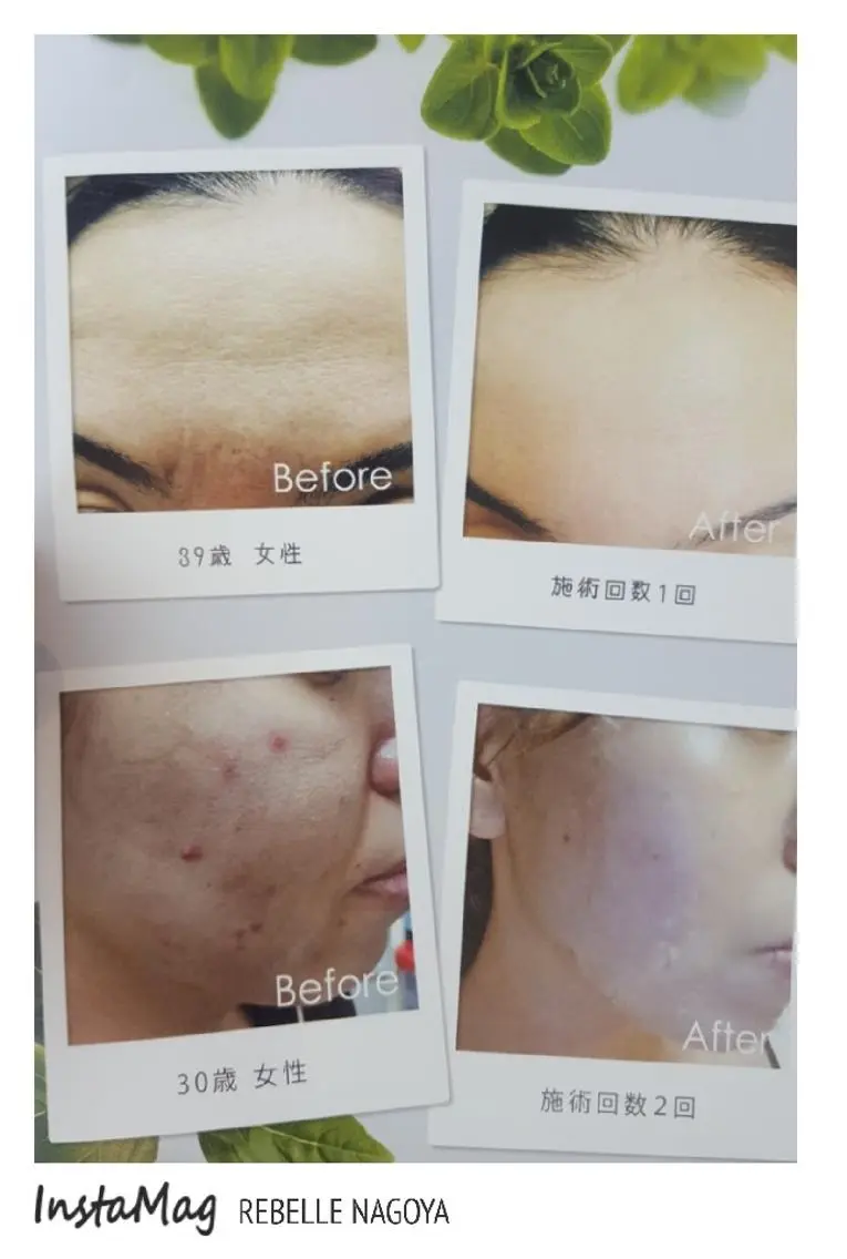 パーマ ヘアアレンジ キッズ メンズ マツエク・マツパ カラー ミディアム 次世代まつげパーマは 『リベル名古屋』のマツエク・マツパデザイン
