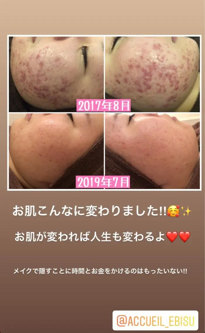 ミディアム カラー パーマ ヘアアレンジ メンズ キッズ ネイル マツエク・マツパ エステ リラク ニキビ・肌質改善専門 ♡人生が変わるサロンのエステ・リラクイメージ