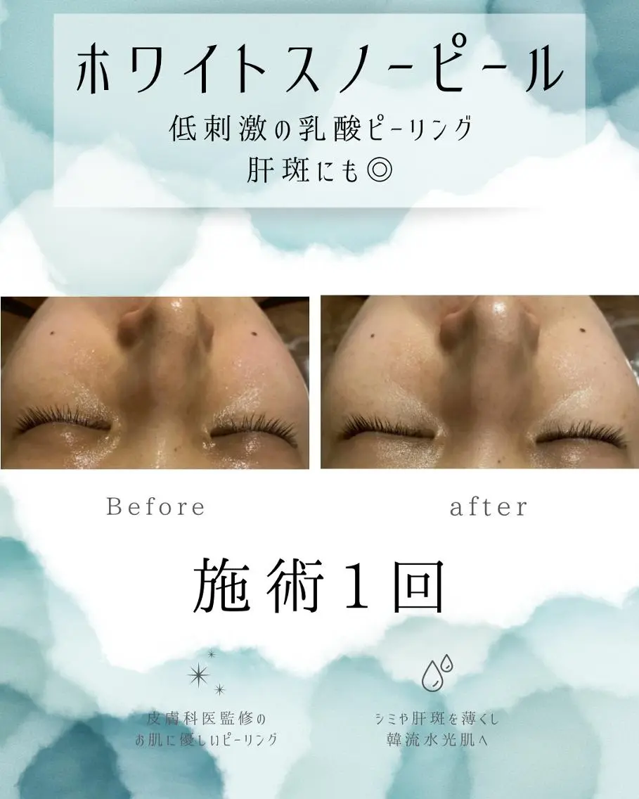 エステ リラク 医療提携 肌管理痩身エステ池袋のエステ・リラクイメージ
