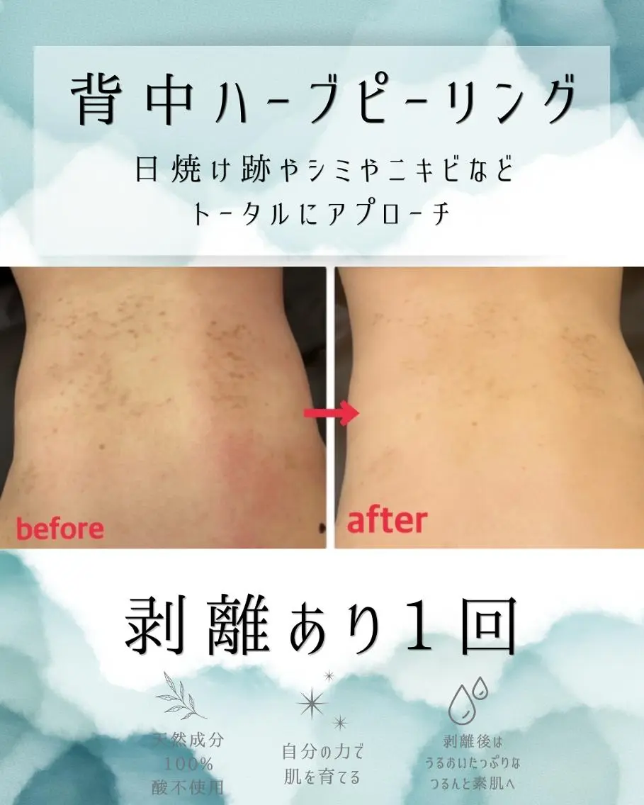 エステ リラク 医療提携 肌管理痩身エステ池袋のエステ・リラクイメージ