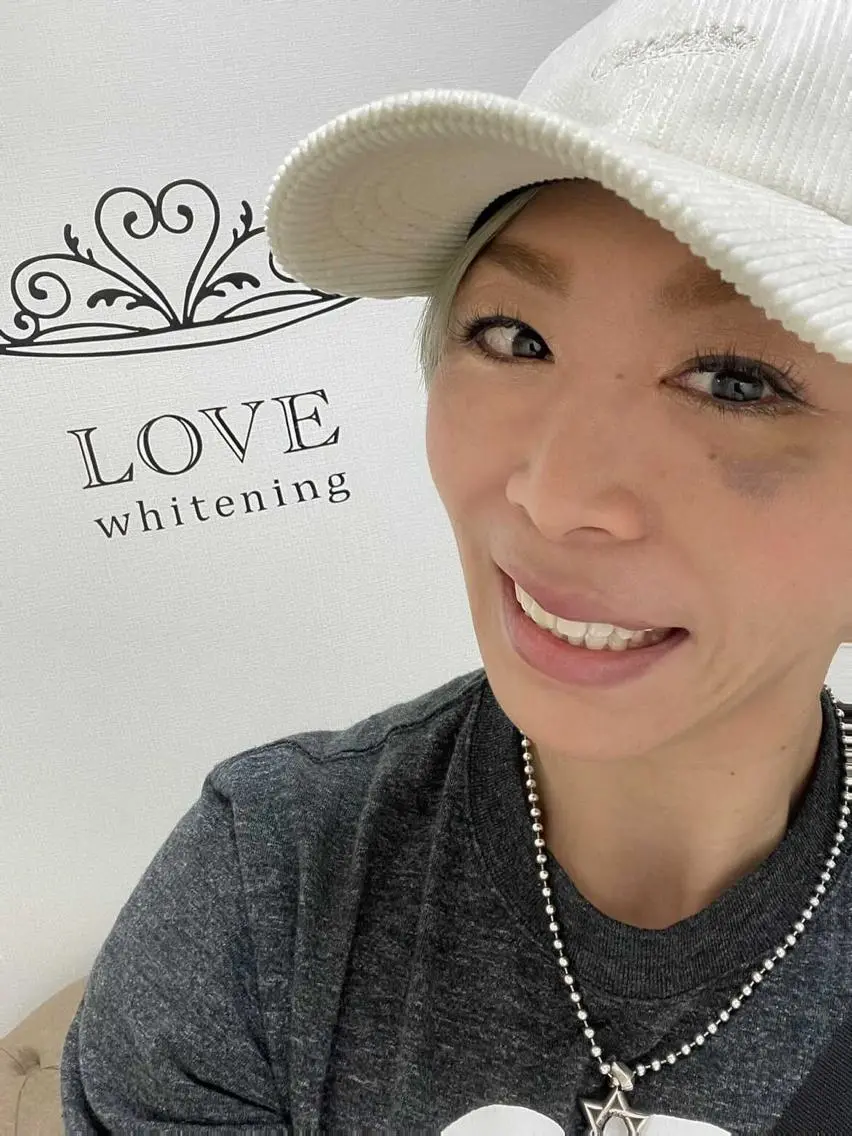ショート カラー パーマ ヘアアレンジ メンズ キッズ ネイル マツエク・マツパ ジェルネイル ホワイト その他 LOVE ホワイトニング銀座店のその他イメージ