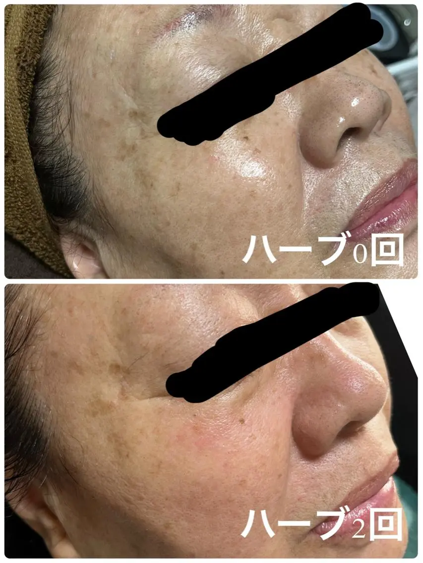 SALON BioBioのエステ・リラクイメージ