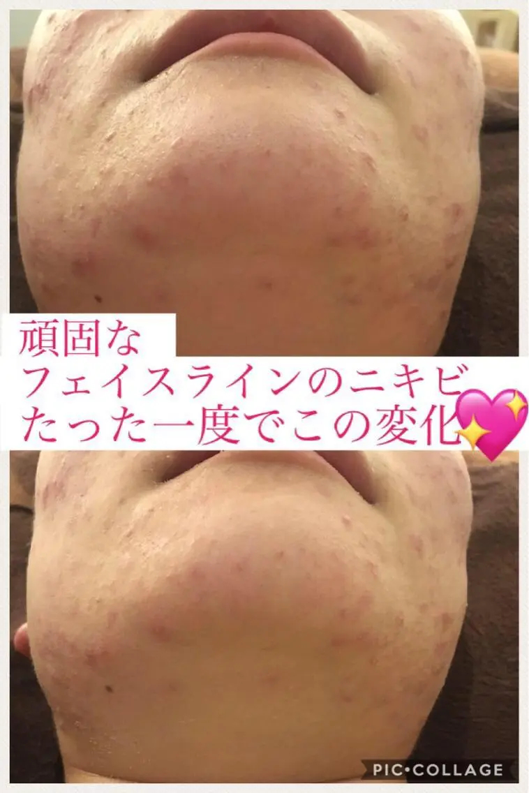 ミディアム カラー パーマ ヘアアレンジ メンズ キッズ ネイル マツエク・マツパ エステ リラク ニキビ・肌質改善専門 ♡人生が変わるサロンのエステ・リラクイメージ