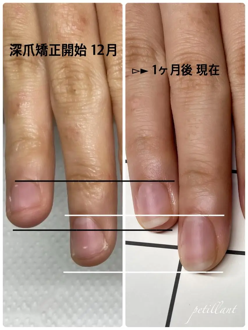 ネイル 長さ出し ジェルネイル ピンク nail salon petillantのネイルデザイン