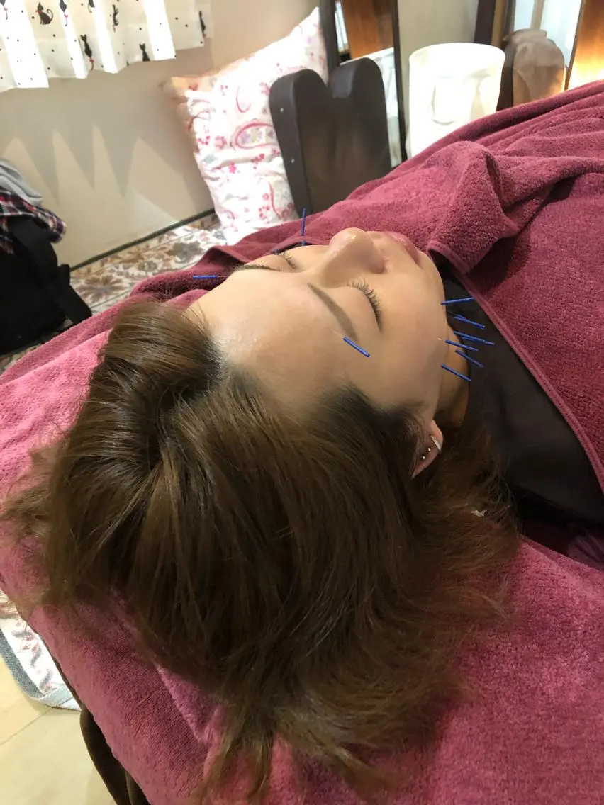 美容鍼灸女性専用 りんご鍼灸治療院のその他イメージ