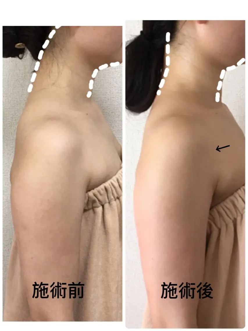 美筋骨格リンパ®️ Aroleのエステ・リラクイメージ