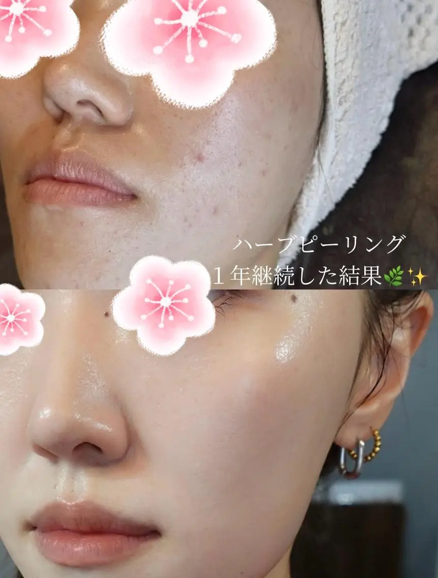 エステ 🩵Ni na🫧のエステ・リラクイメージ