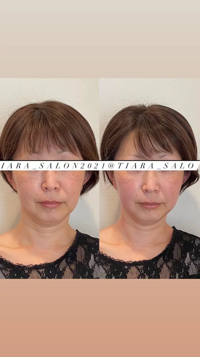 セミロング カラー パーマ ヘアアレンジ メンズ キッズ ネイル マツエク・マツパ アイブロウ 鍼灸サロン TIARA　美容鍼のエステ・リラクイメージ
