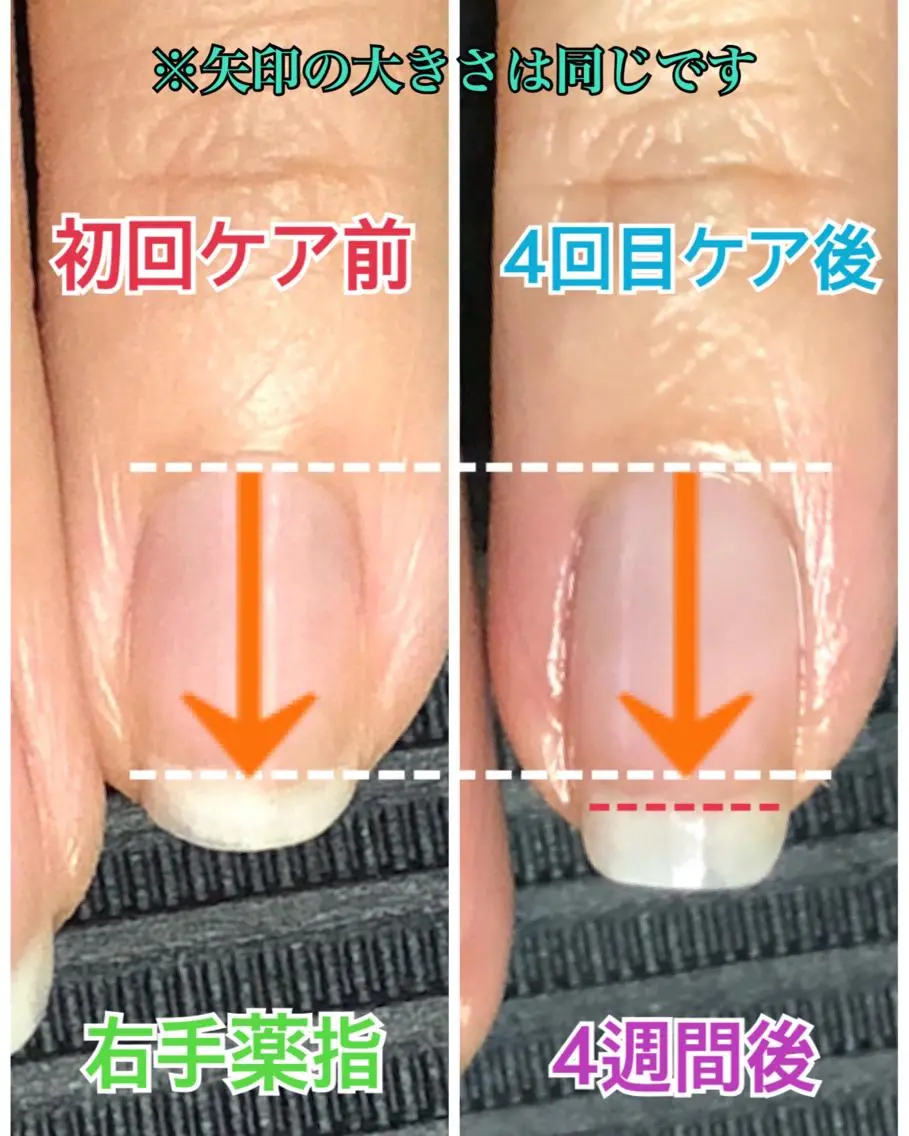 ネイル その他(ネイル) 自爪育成ネイルサロン Pause(ポーズ)のネイルデザイン