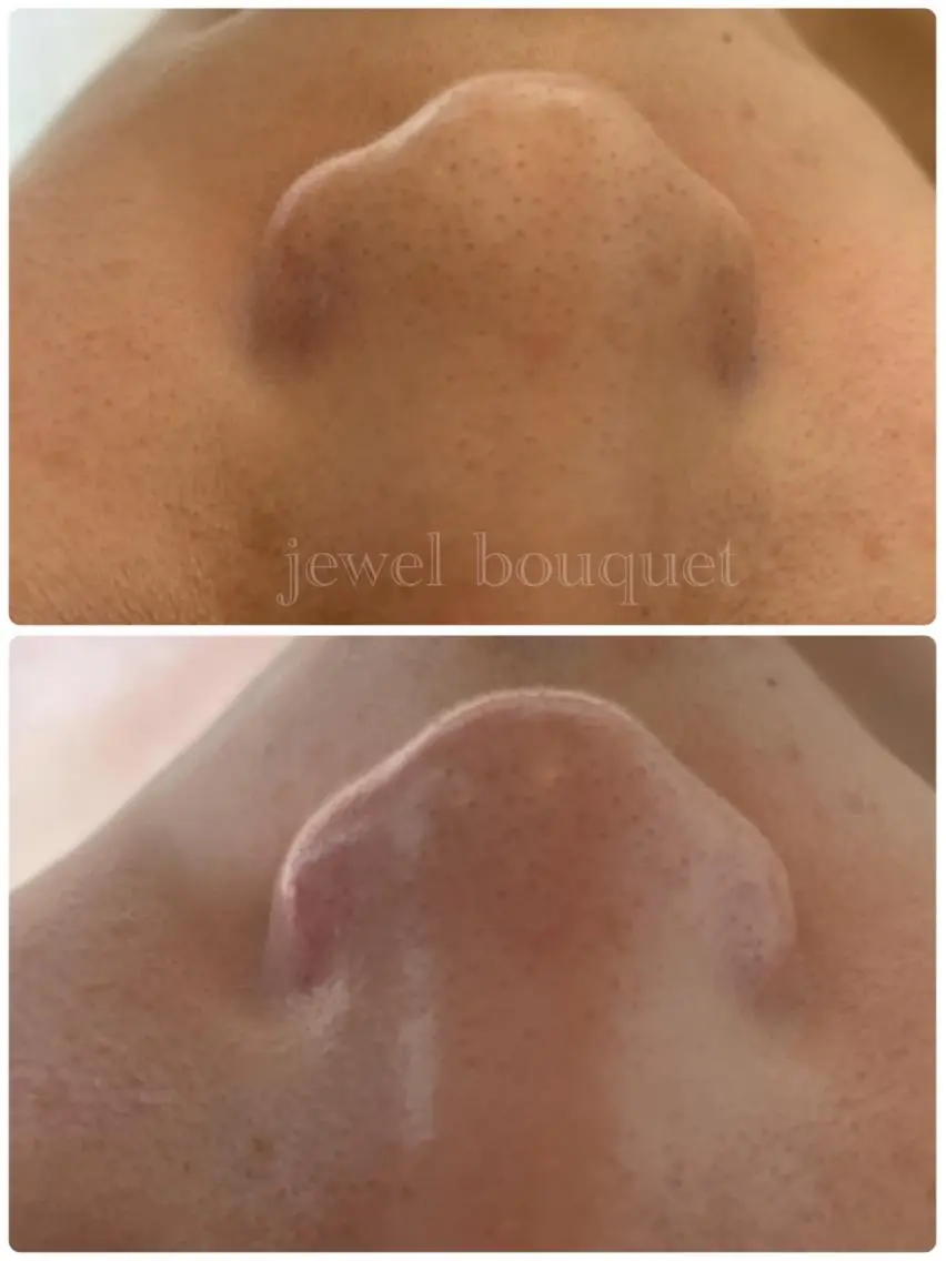 jewel bouquetのエステ・リラクイメージ