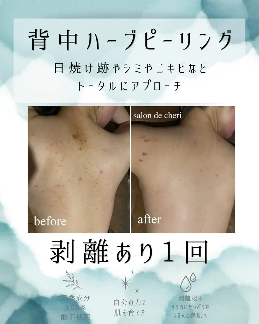 エステ リラク 医療提携 肌管理痩身エステ池袋のエステ・リラクイメージ