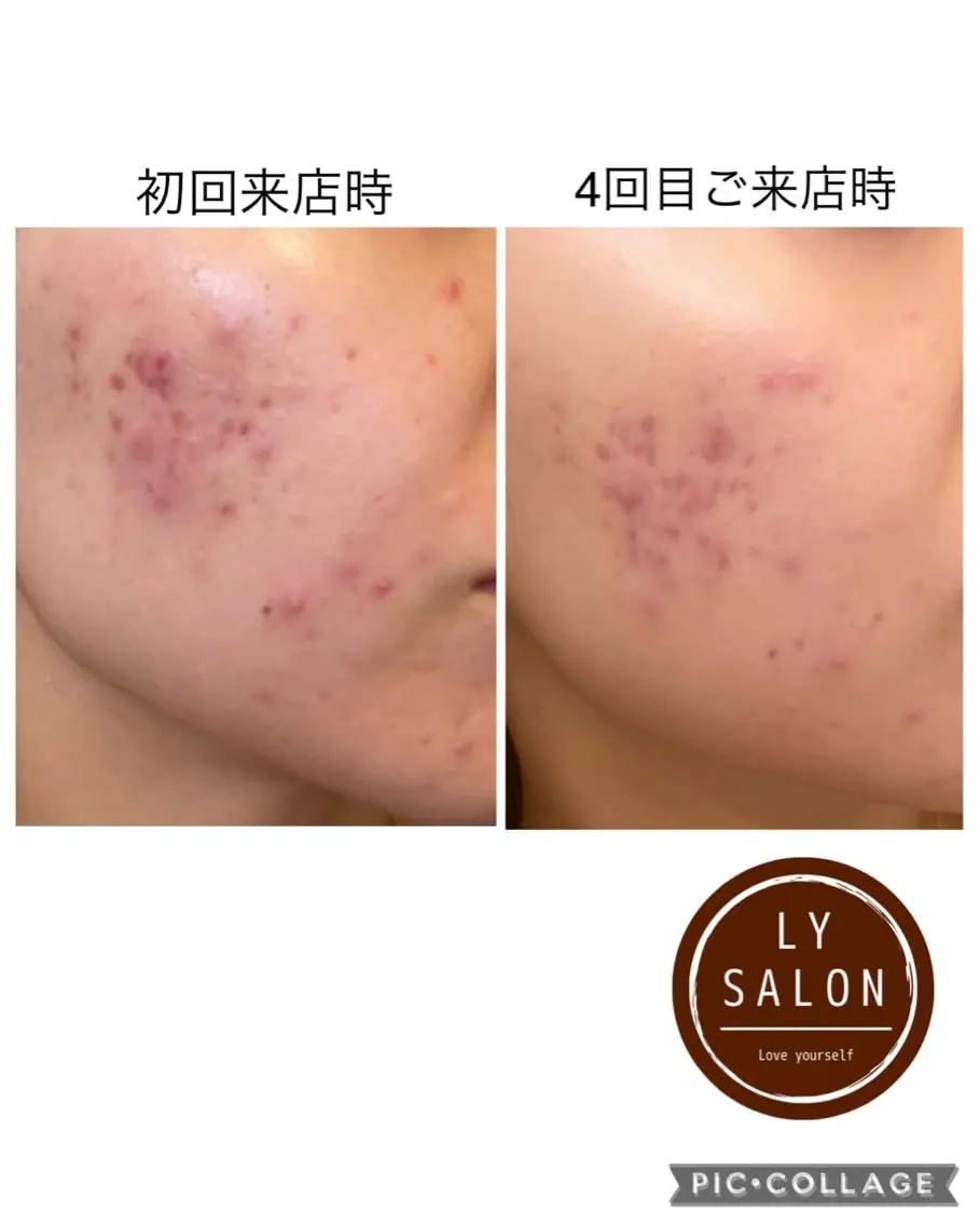 LY　SALON♡ トータルビューティーのエステ・リラクイメージ
