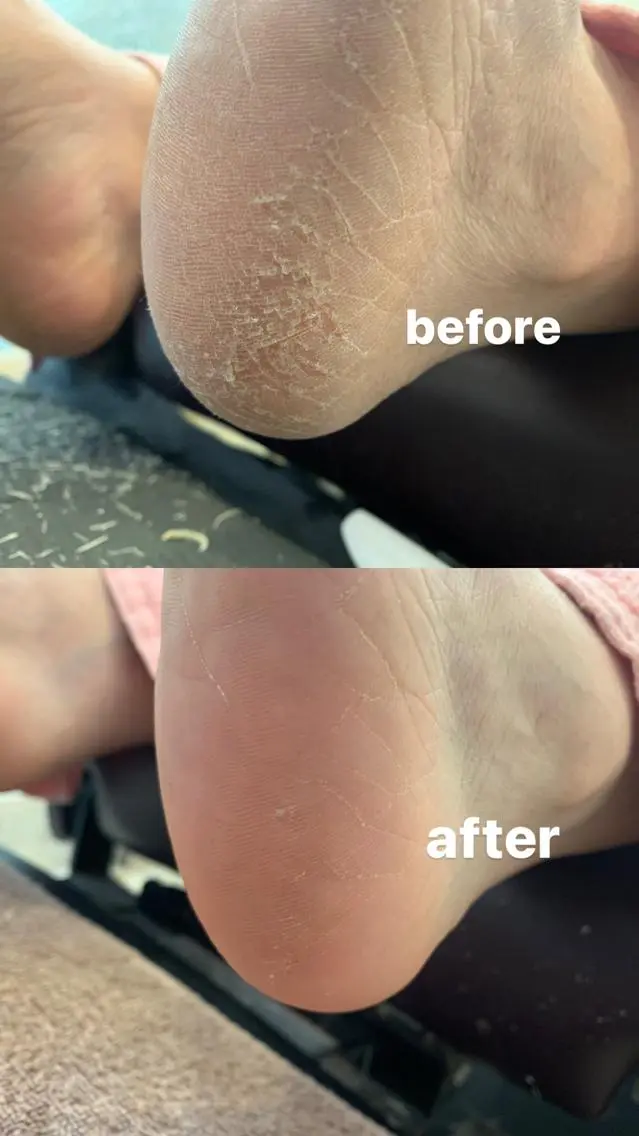 ネイル フットネイル クレンバイマリー ヤマトのネイルデザイン