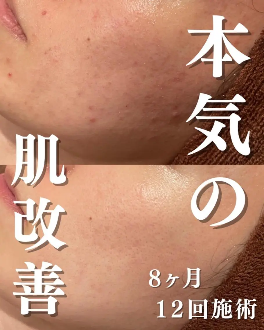 エステ リラク 美容まるっと ビヨマルのエステ・リラクイメージ