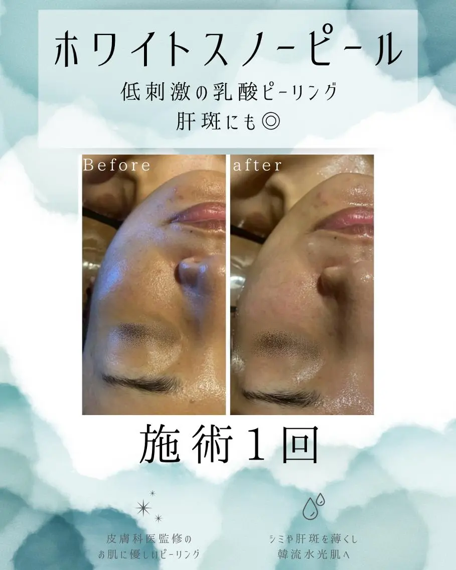 エステ リラク 医療提携 肌管理痩身エステ池袋のエステ・リラクイメージ