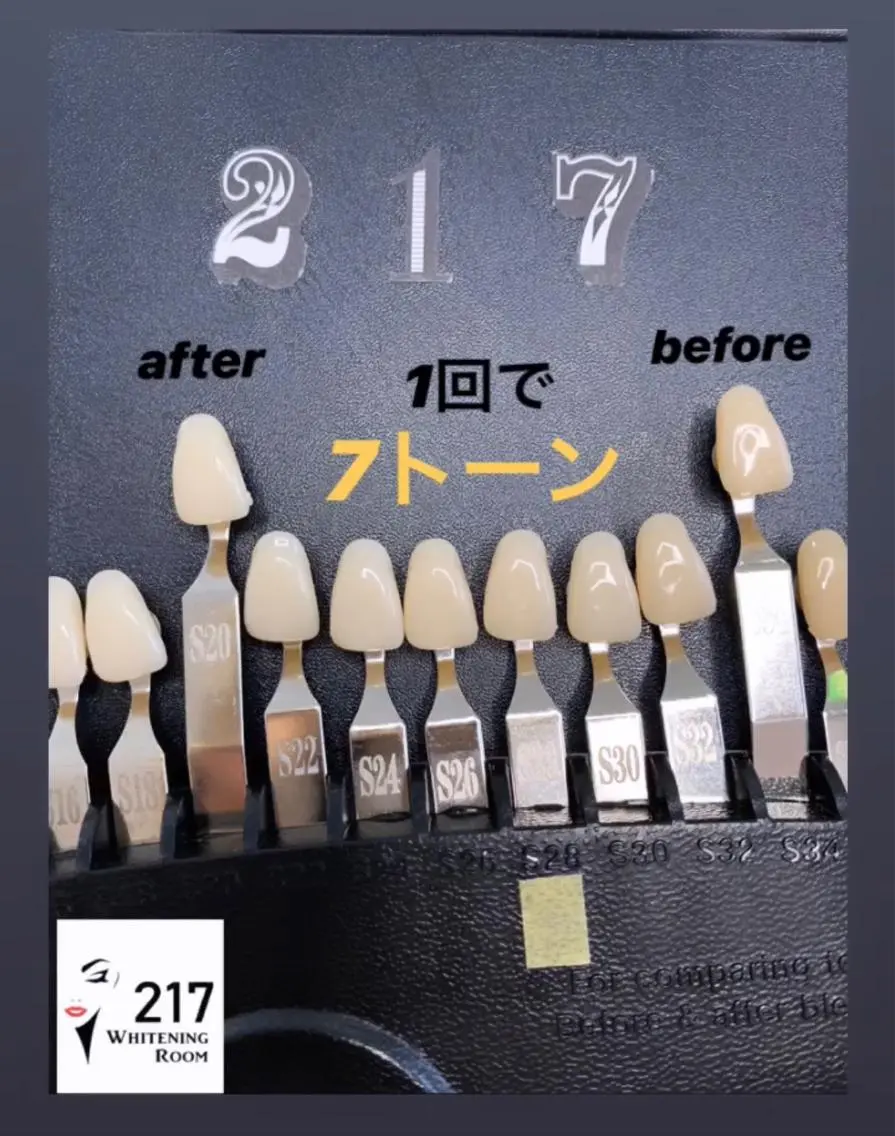 メンズ キッズ その他 217 ホワイトニングルームのエステ・リラクイメージ