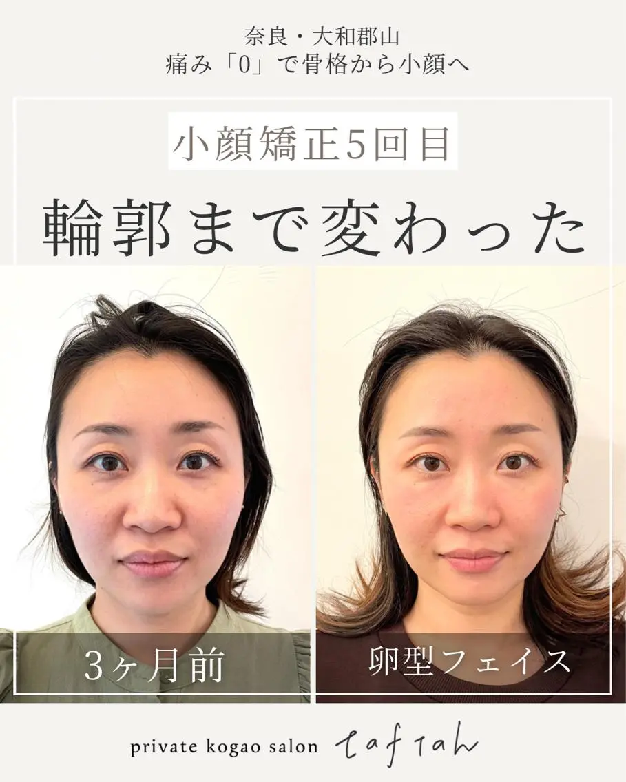 小顔   目元専門 taftahタフタのマツエク・マツパデザイン