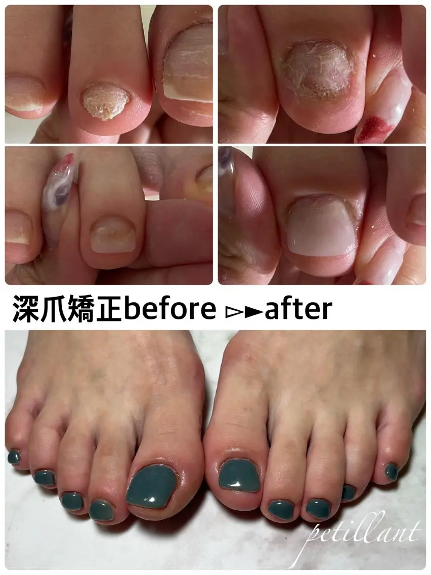 ネイル 長さ出し ジェルネイル nail salon petillantのネイルデザイン