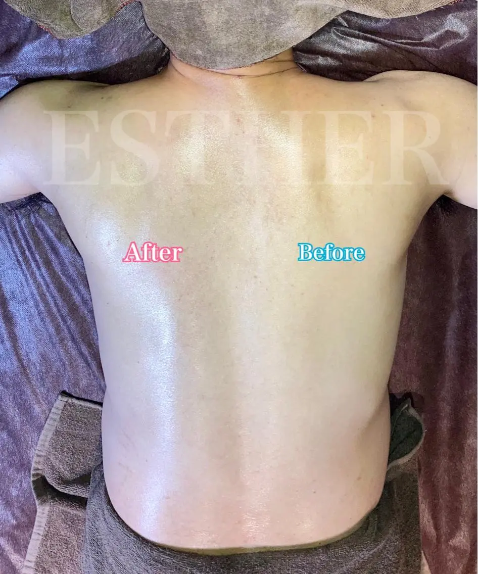 ESTHER (エステル)のエステ・リラクイメージ